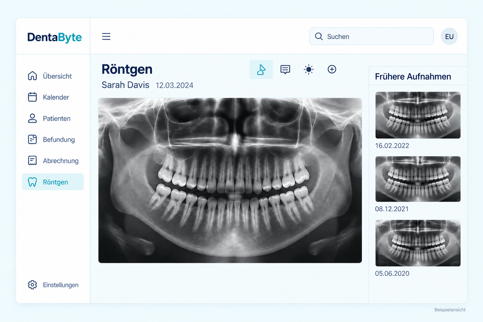 DentaByte Röntgenbildbetrachter — illustrative Softwareansicht